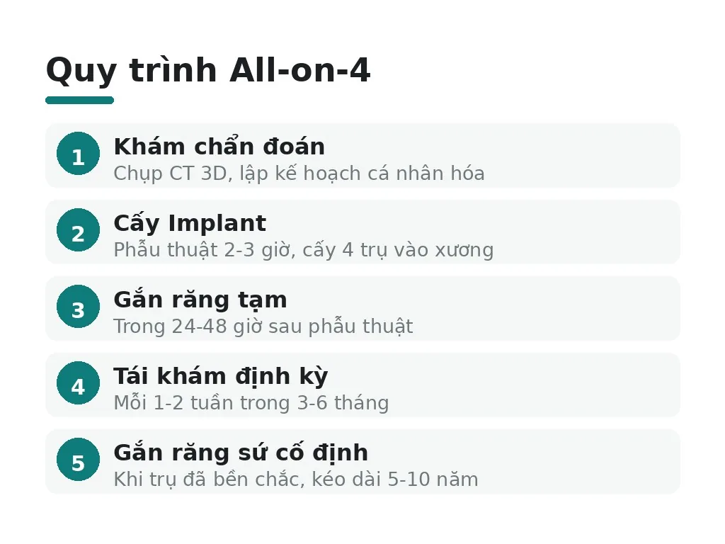 Quy trình All-on-4 từ khám đến hoàn thiện diễn ra thế nào?