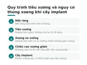 Quy trình tiêu xương và nguy cơ thủng xoang khi cấy implant