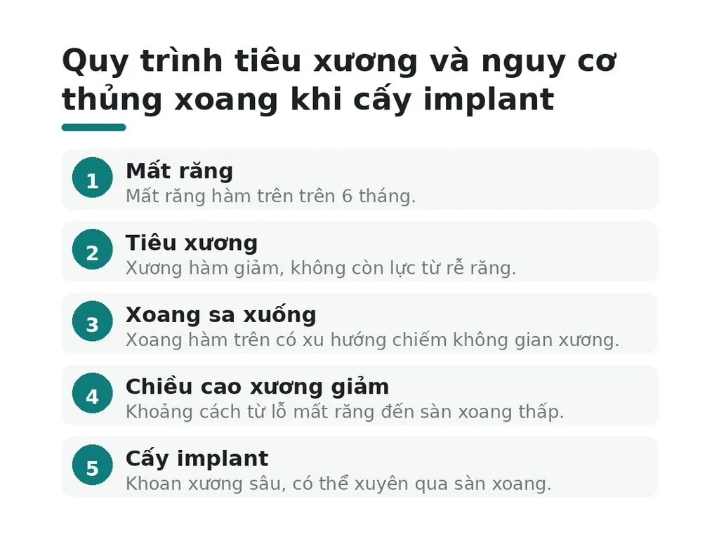 Giải phẫu xoang hàm và vì sao dễ thủng khi cấy implant