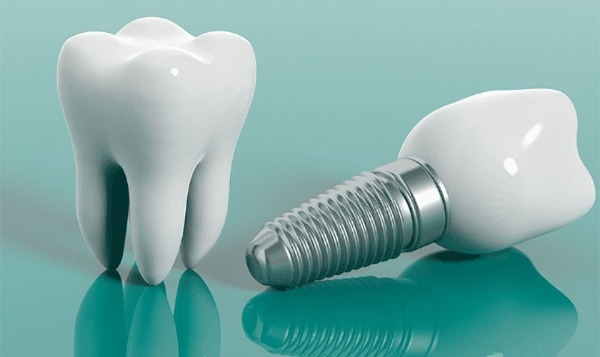 Implant neodent