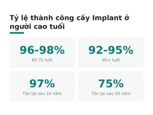 Tỷ lệ thành công cấy Implant ở người cao tuổi