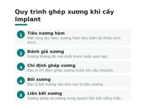 Quy trình ghép xương khi cấy Implant