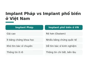 Implant Pháp vs Implant phổ biến ở Việt Nam