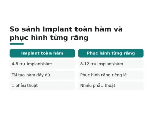 So sánh Implant toàn hàm và phục hình từng răng