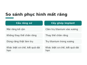 So sánh phục hình mất răng