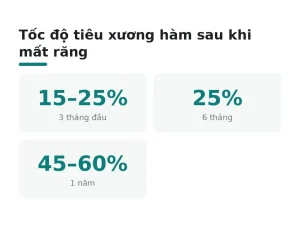 Tốc độ tiêu xương hàm sau khi mất răng