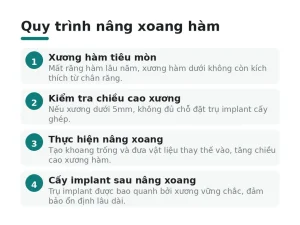 Quy trình nâng xoang hàm