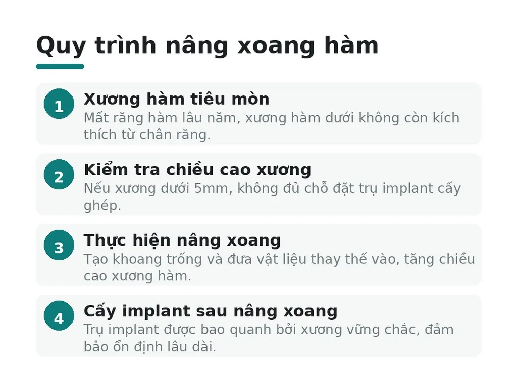 Tại sao nâng xoang hàm cần thiết trước cấy implant?