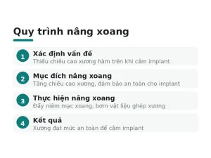 Quy trình nâng xoang