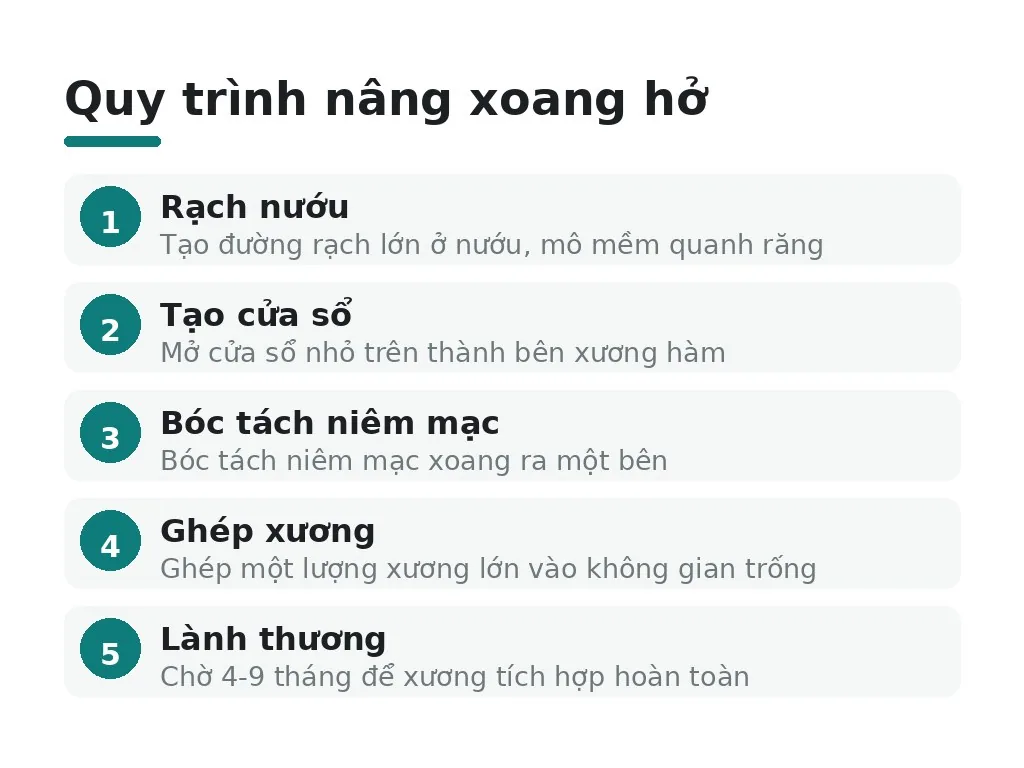 Nâng xoang hở: phương pháp, chỉ định và thời gian chờ