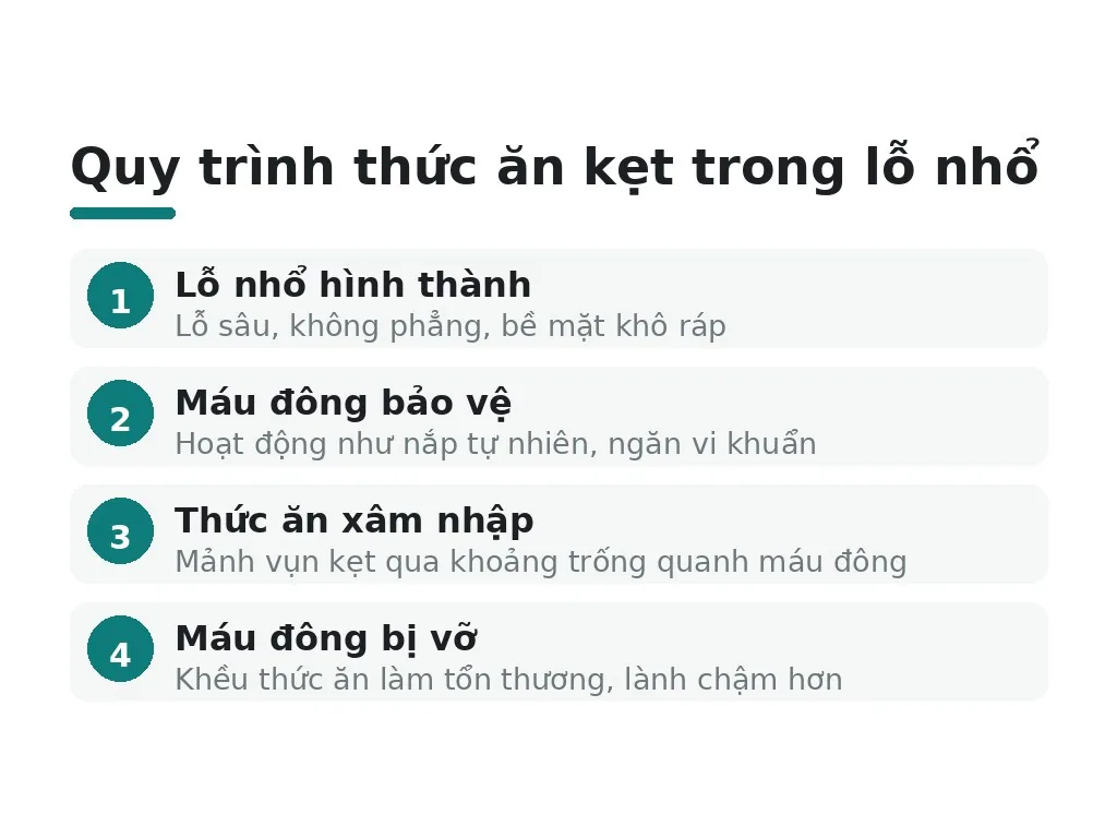 Tại sao thức ăn dễ kẹt trong lỗ nhổ răng khôn?