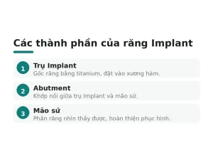 Các thành phần của răng Implant