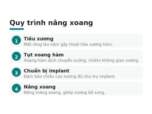 Quy trình nâng xoang