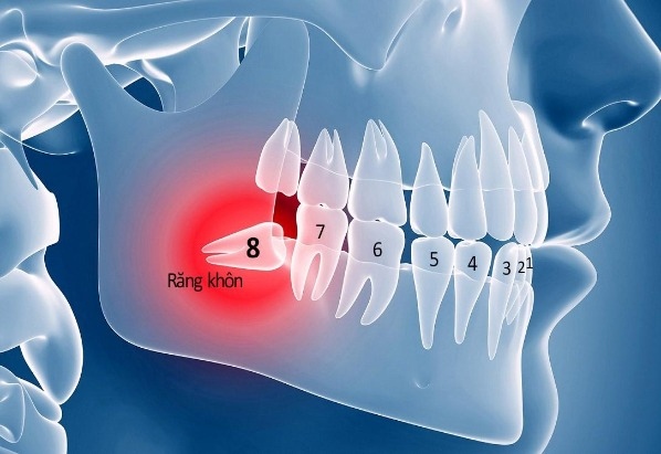Khi nào cần tìm kiếm chăm sóc chuyên khoa?