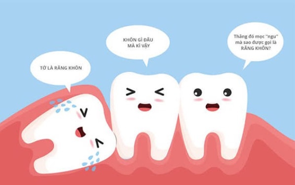 Tê môi sau nhổ răng khôn hàm dưới