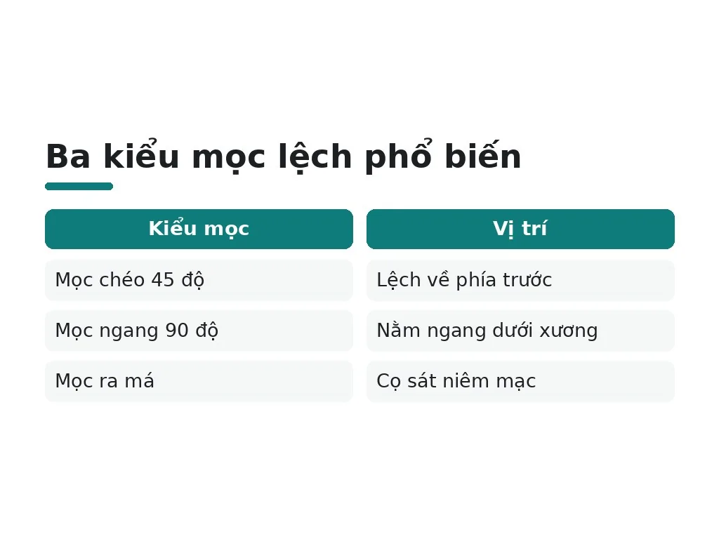 Răng khôn là gì và tại sao nó lại mọc lệch?