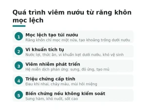 Quá trình viêm nướu từ răng khôn mọc lệch