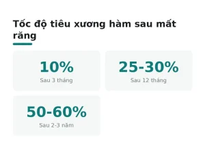 Tốc độ tiêu xương hàm sau mất răng