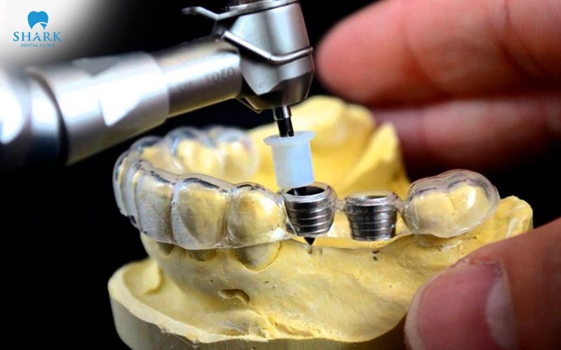 Kết nối côn và lục giác