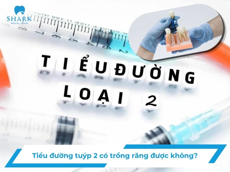 Cấy implant không lật vạt