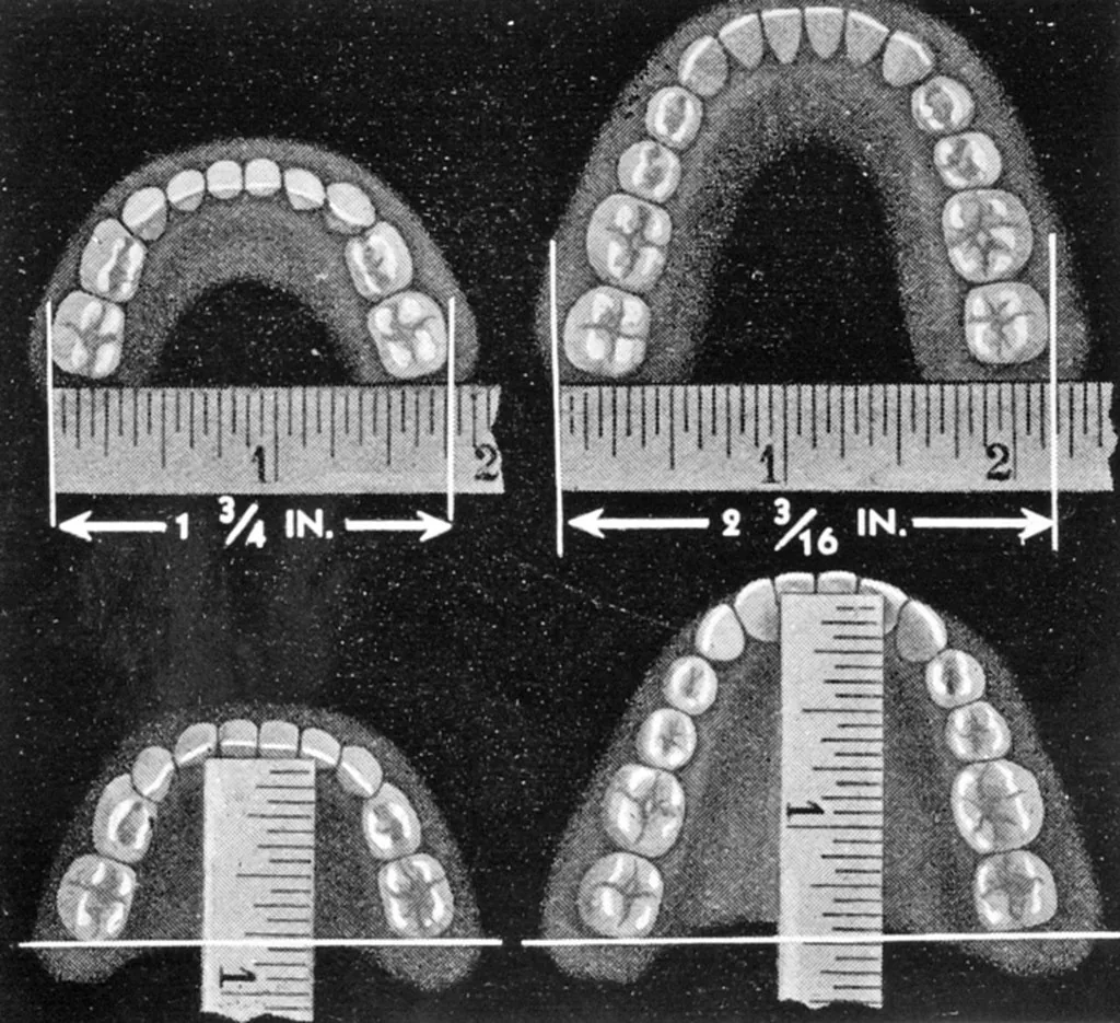 Chuẩn bị thông tin thuốc trước khi làm implant